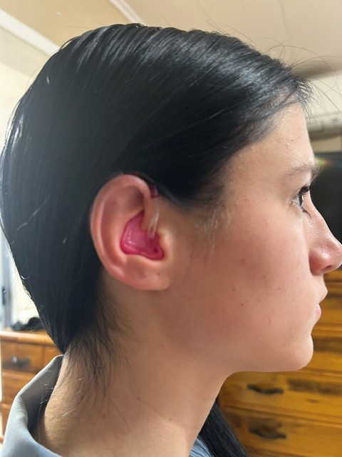 Picture of Kiara wearing her hearing aid